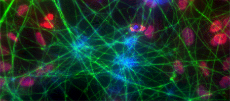 neurons-Cropped-454x200-3.gif