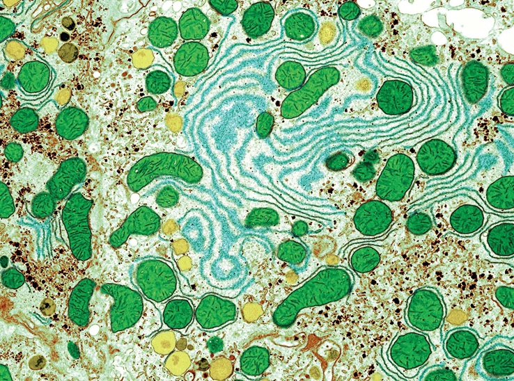 31---Liver-Cells.jpg