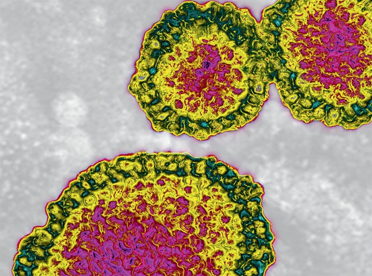 128---Influenza-A-H1N1-virus-particles.jpg