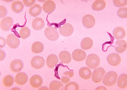 African-trypanosomiasis-1.jpg