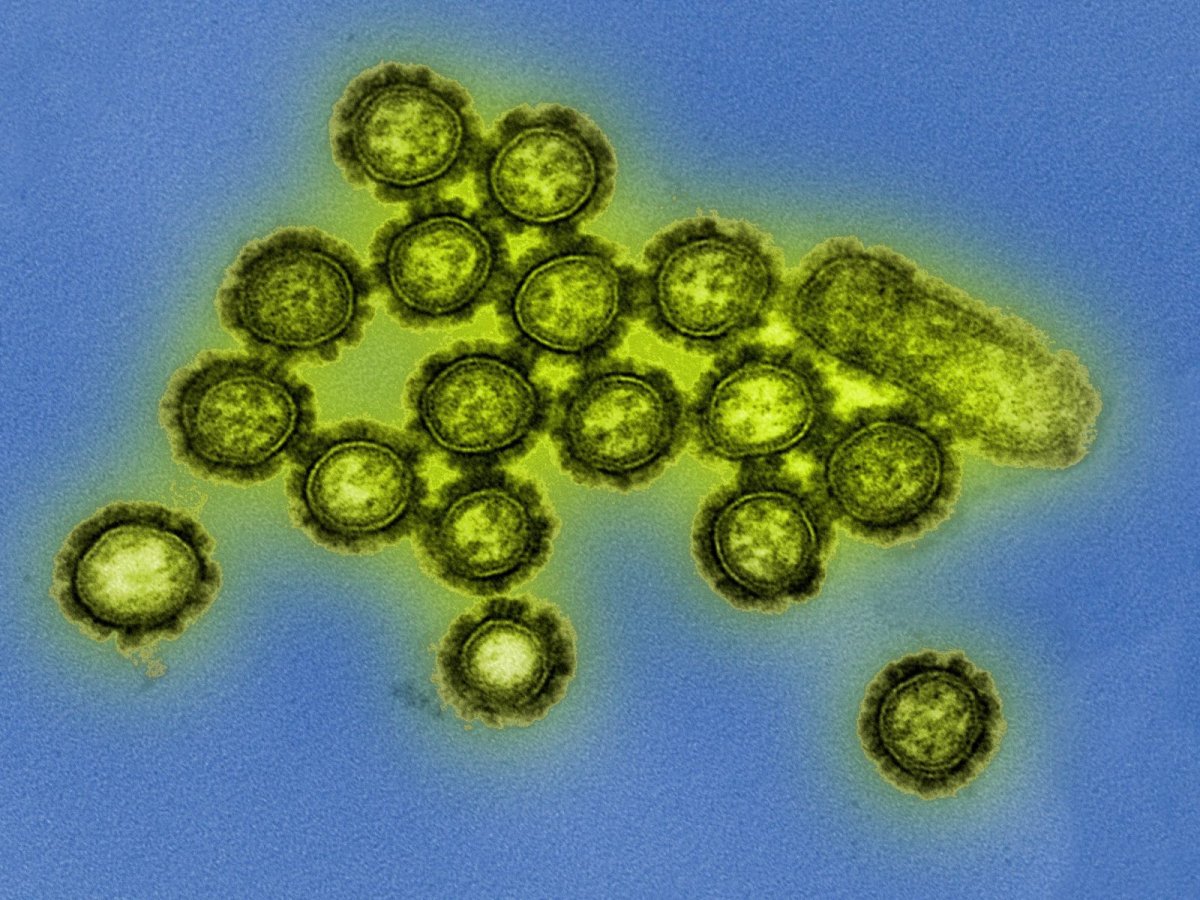 Influenza-1.jpg