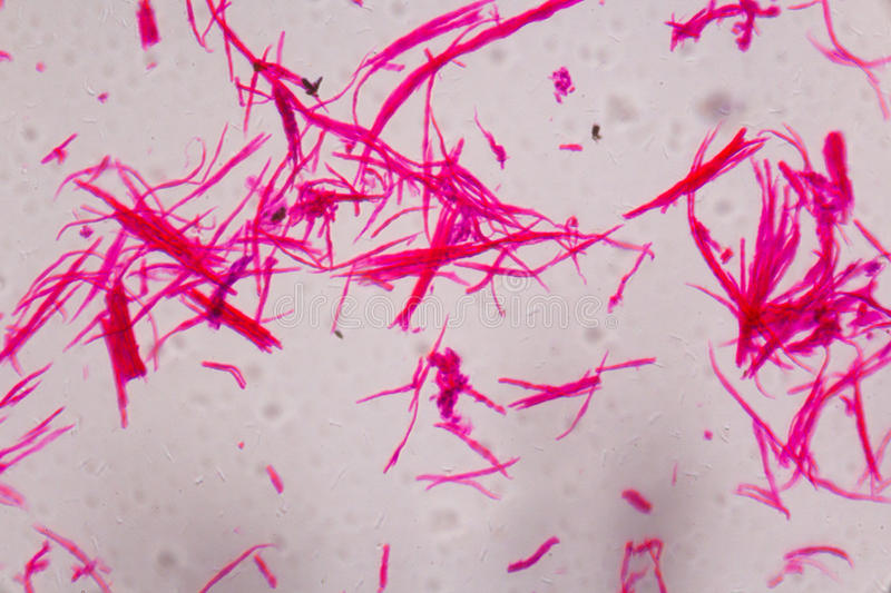 músculo-liso-separado-debajo-del-microscopio-línea-rosada-abstracta-69247660.jpg