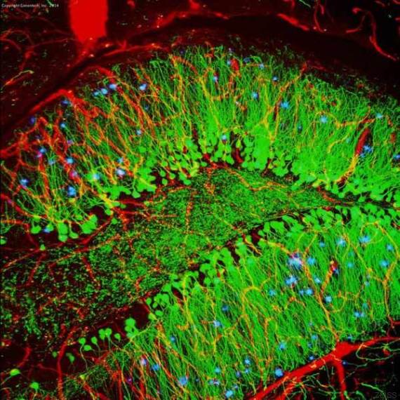 o-ALZHEIMER-570.jpg