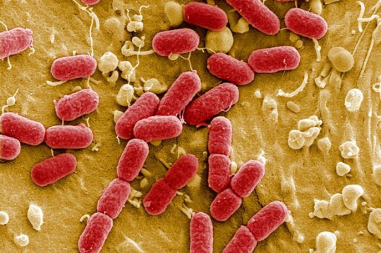 Yersinia-pestis.jpg