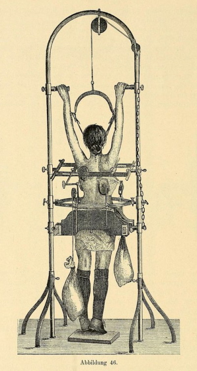 apparatus for scoliosis.jpg